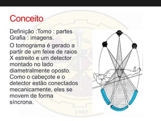 Conceito
Definição :Tomo : partes
Grafia : imagens.
O tomograma é gerado a
partir de um feixe de raios
X estreito e um detector
montado no lado
diametralmente oposto.
Como o cabeçote e o
detector estão conectados
mecanicamente, eles se
movem de forma
síncrona.
 