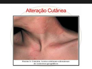 Alteração Cutânea
 