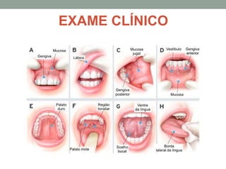 EXAME CLÍNICO
 