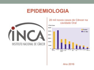 EPIDEMIOLOGIA
Ano 2016
20 mil novos casos de Câncer na
cavidade Oral
 