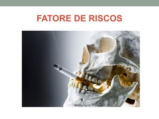 FATORE DE RISCOS
 