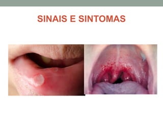 SINAIS E SINTOMAS
 