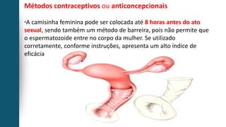 Métodos contraceptivos ou anticoncepcionais
“A camisinha feminina pode ser colocada até 8 horas antes do ato
sexual, sendo também um método de barreira, pois não permite que
o espermatozoide entre no corpo da mulher. Se utilizado
corretamente, conforme instruções, apresenta um alto índice de
eficácia
 