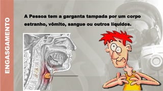 A Pessoa tem a garganta tampada por um corpo
estranho, vômito, sangue ou outros líquidos.
ENGASGAMENTO
 