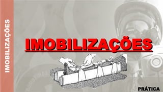 IMOBILIZAÇÕES
IMOBILIZAÇÕES
IMOBILIZAÇÕES
PRÁTICA
 