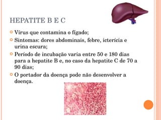 HEPATITE B E C Vírus que contamina o fígado; Sintomas: dores abdominais, febre, icterícia e urina escura; Período de incubação varia entre 50 e 180 dias para a hepatite B e, no caso da hepatite C de 70 a 90 dias; O portador da doença pode não desenvolver a doença.  