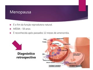 Menopausa
 É o fim da função reprodutora natural.
 MÉDIA - 50 anos
 É reconhecida após passados 12 meses de amenorréia.
Diagnóstico
retrospectivo
 