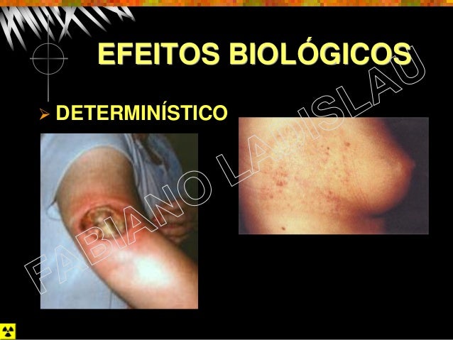 Palestra de Efeitos Biológicos das Radiações Ionizantes
