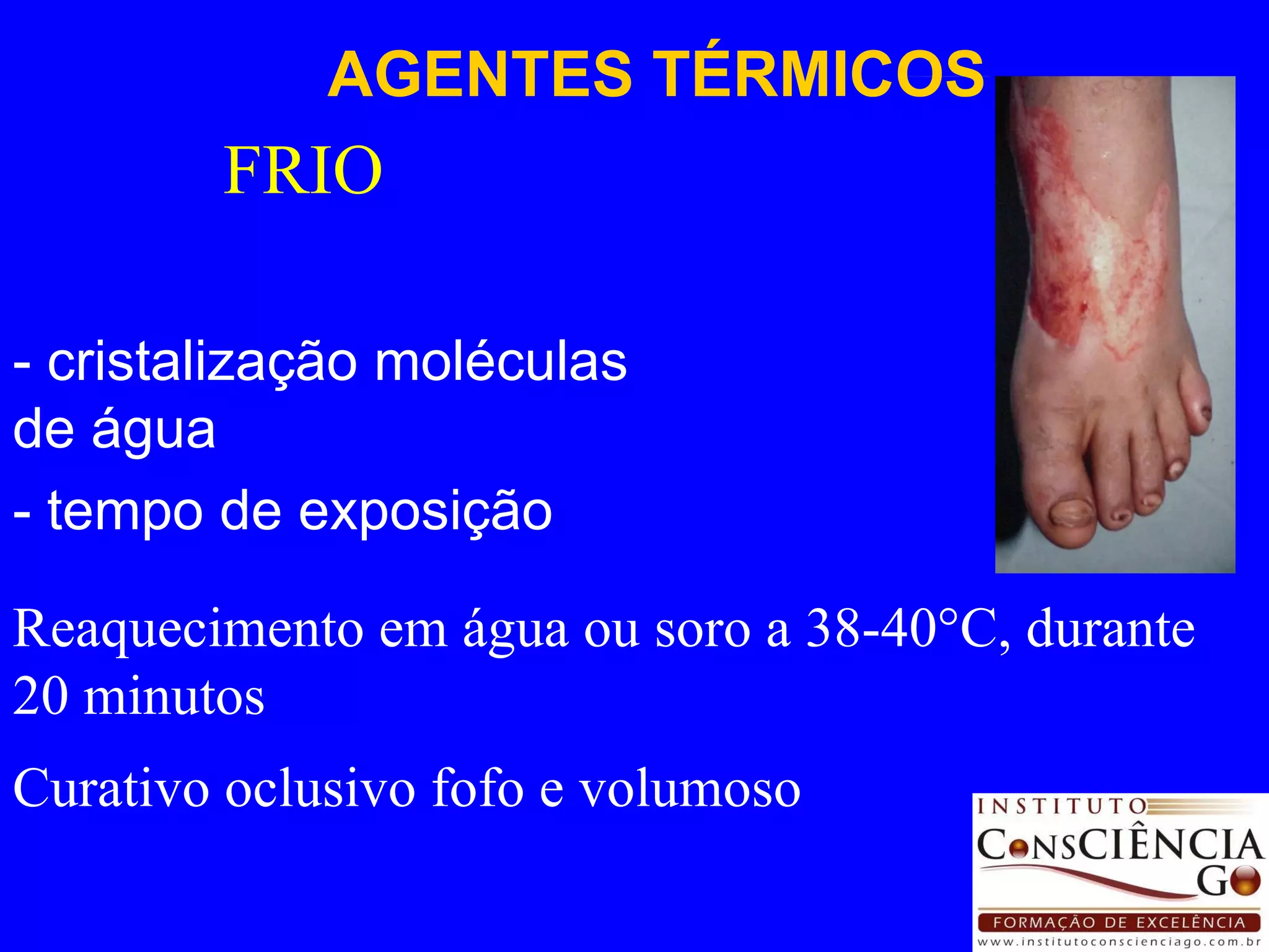 FRIO - cristalização moléculas de água  - tempo de exposição AGENTES TÉRMICOS Reaquecimento em água ou soro a 38-40°C, durante 20 minutos  Curativo oclusivo fofo e volumoso 