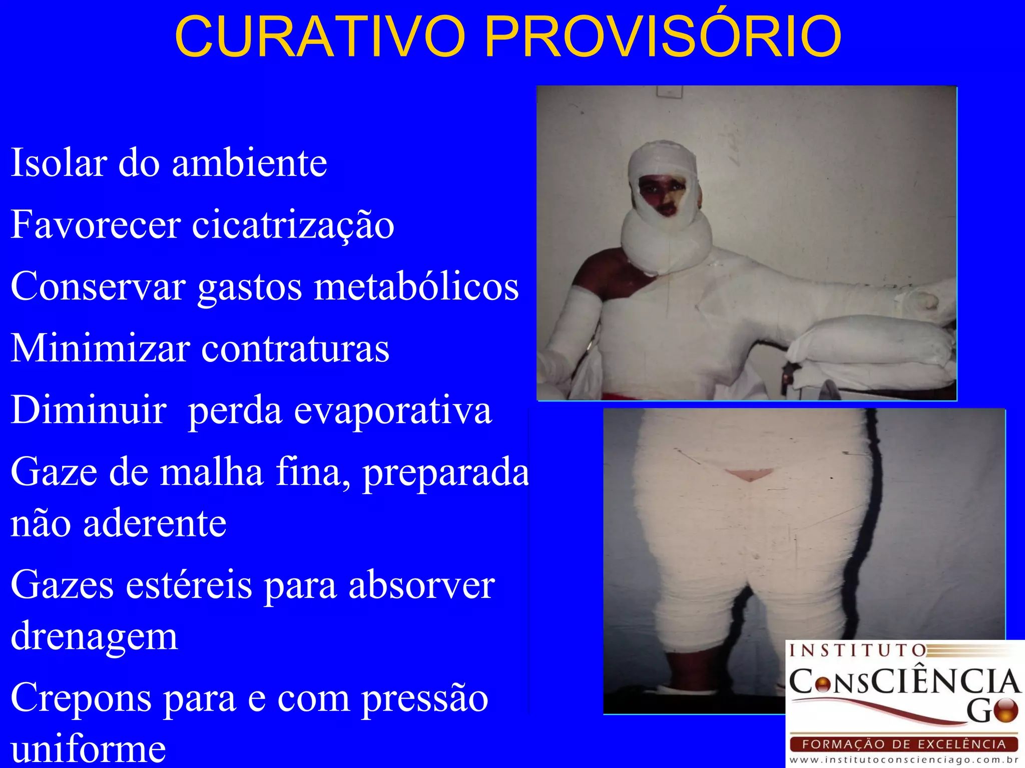 CURATIVO PROVISÓRIO Isolar do ambiente Favorecer cicatrização Conservar gastos metabólicos Minimizar contraturas Diminuir  perda evaporativa Gaze de malha fina, preparada, não aderente Gazes estéreis para absorver drenagem Crepons para e com pressão uniforme 