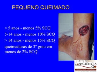< 5 anos - menos 5% SCQ 5-14 anos - menos 10% SCQ > 14 anos - menos 15% SCQ queimaduras de 3° grau em menos de 2% SCQ PEQUENO QUEIMADO 