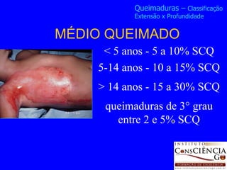 < 5 anos - 5 a 10% SCQ 5-14 anos - 10 a 15% SCQ > 14 anos - 15 a 30% SCQ queimaduras de 3° grau entre 2 e 5% SCQ MÉDIO QUEIMADO Queimaduras –  Classificação  Extensão x Profundidade 