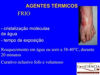 FRIO - cristalização moléculas de água  - tempo de exposição AGENTES TÉRMICOS Reaquecimento em água ou soro a 38-40°C, durante 20 minutos  Curativo oclusivo fofo e volumoso 