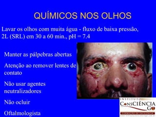 QUÍMICOS NOS OLHOS Manter as pálpebras abertas Atenção ao remover lentes de contato Não usar agentes neutralizadores Não ocluir Oftalmologista Lavar os olhos com muita água - fluxo de baixa pressão, 2L (SRL) em 30 a 60 min., pH = 7.4 