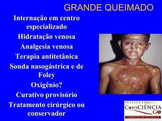 Internação em centro especializado Hidratação venosa Analgesia venosa Terapia antitetânica Sonda nasogástrica e de Foley Oxigênio? Curativo provisório Tratamento cirúrgico ou conservador GRANDE QUEIMADO 