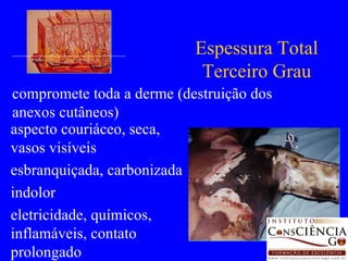 aspecto couriáceo, seca, vasos visíveis esbranquiçada, carbonizada indolor eletricidade, químicos, inflamáveis, contato prolongado Espessura Total Terceiro Grau compromete toda a derme (destruição dos anexos cutâneos) 