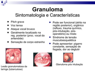 Granuloma Sintomatologia e Características Pitch grave Voz tensa Ataque vocal brusco Geralmente localizado na reg. posterior (proc. vocal da aritenóide) Sensação de corpo estranho Pode ser funcional (atrito na região posterior), orgânico (refluxo, trauma químico, pós-intubação, pós-operatório) ou misto Síndrome de tensão musculoesquelética Pode apresentar: pigarro constante, sensação de fisgada, dor ao deglutir Glanuloma pós intubação Lesão granulomatosa da laringe (tuberculose) 