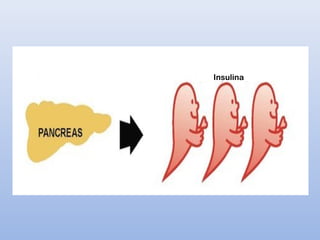 Insulina
 