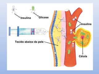 Insulina Glicose
Insulina
Tecido abaixo da pele
Célula
 