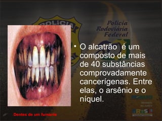 • O alcatrão é um
composto de mais
de 40 substâncias
comprovadamente
cancerígenas. Entre
elas, o arsênio e o
níquel.
Dentes de um fumante
 