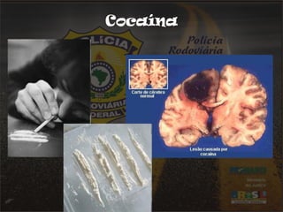 Cocaína 
 