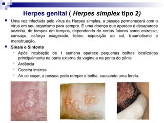 Herpes genital ( Herpes simplex tipo 2)
 Uma vez infectada pelo vírus da Herpes simples, a pessoa permanecerá com o
vírus em seu organismo para sempre. É uma doença que aparece e desaparece
sozinha, de tempos em tempos, dependendo de certos fatores como estresse,
cansaço, esforço exagerado, febre, exposição ao sol, traumatismo e
menstruação.
 Sinais e Sintoma
 Após incubação de 1 semana aparece pequenas bolhas localizadas
principalmente na parte externa da vagina e na ponta do pênis
 Ardência
 Coceira intensa
 Ao se coçar, a pessoa pode romper a bolha, causando uma ferida.
 