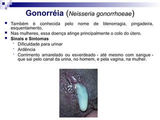 Gonorréia (Neisseria gonorrhoeae)
 Também é conhecida pelo nome de blenorragia, pingadeira,
esquentamento.
 Nas mulheres, essa doença atinge principalmente o colo do útero.
 Sinais e Sintomas
 Dificuldade para urinar
 Ardência
 Corrimento amarelado ou esverdeado - até mesmo com sangue -
que sai pelo canal da urina, no homem, e pela vagina, na mulher.
 