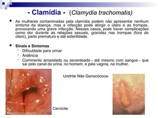 - Clamídia - (Clamydia trachomatis)
 As mulheres contaminadas pela clamídia podem não apresentar nenhum
sintoma da doença, mas a infecção pode atingir o útero e as trompas,
provocando uma grave infecção. Nesses casos, pode haver complicações
como dor durante as relações sexuais, gravidez nas trompas (fora do
útero), parto prematuro e até esterilidade.
 Sinais e Sintomas
 Dificuldade para urinar
 Ardência
 Corrimento amarelado ou esverdeado - até mesmo com sangue - que
sai pelo canal da urina, no homem, e pela vagina, na mulher.
Cervicite
Uretrite Não Gonocócoca-
 