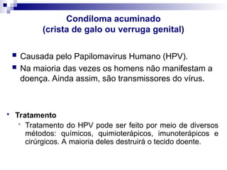 Condiloma acuminado
(crista de galo ou verruga genital)
 Causada pelo Papilomavirus Humano (HPV).
 Na maioria das vezes os homens não manifestam a
doença. Ainda assim, são transmissores do vírus.
 Tratamento
 Tratamento do HPV pode ser feito por meio de diversos
métodos: químicos, quimioterápicos, imunoterápicos e
cirúrgicos. A maioria deles destruirá o tecido doente.
 
