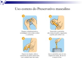 Uso correto do Preservativo masculino
 