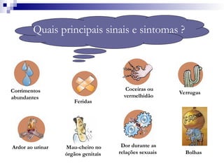 Quais principais sinais e sintomas ?
Corrimentos
abundantes
Mau-cheiro no
órgãos genitais
Coceiras ou
vermelhidão
Feridas
Verrugas
Bolhas
Ardor ao urinar Dor durante as
relações sexuais
 