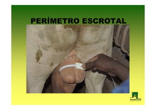 PERÍMETRO ESCROTAL
 