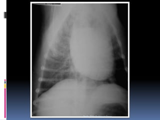 Profa. Tilde Rodrigues Froes