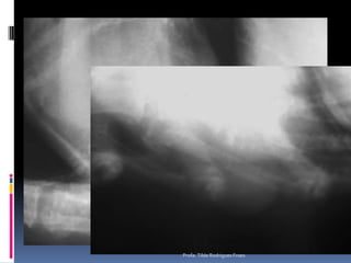 Profa. Tilde Rodrigues Froes