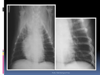 Profa. Tilde Rodrigues Froes