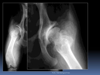 Profa. Tilde Rodrigues Froes