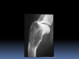 Profa. Tilde Rodrigues Froes