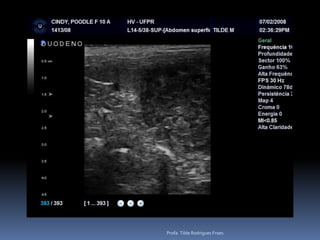 Pesquisar as adrenaisHiperplasia nodular – 6 (7,9%)Nódulo focal – 2(2,6%)Aspecto massa- 1 (1,3%)HSA[   ] – O quanto não vale a pena pesquisar antes!Profa. Tilde Rodrigues Froes