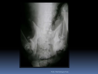 Profa. Tilde Rodrigues Froes