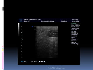 Na nossa rotinaTrato gastrintestinal e acessóriosDoenças pancreáticasNeoplasias abdominaisProfa. Tilde Rodrigues Froes