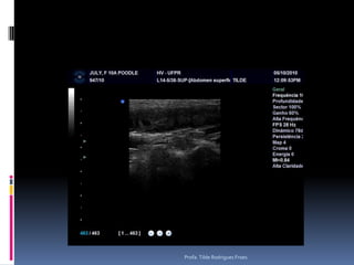 Animal: July, canino, Fêmea, Poodle, 10 anos, corrimento vaginal - sanguinolentoProfa. Tilde Rodrigues Froes