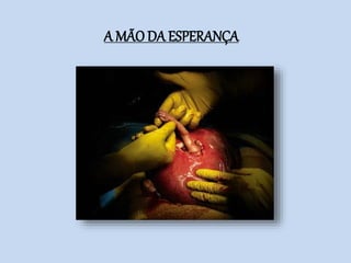 A MÃO DA ESPERANÇA
 