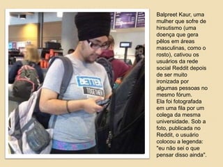Balpreet Kaur, uma 
mulher que sofre de 
hirsutismo (uma 
doença que gera 
pêlos em áreas 
masculinas, como o 
rosto), cativou os 
usuários da rede 
social Reddit depois 
de ser muito 
ironizada por 
algumas pessoas no 
mesmo fórum. 
Ela foi fotografada 
em uma fila por um 
colega da mesma 
universidade. Sob a 
foto, publicada no 
Reddit, o usuário 
colocou a legenda: 
"eu não sei o que 
pensar disso ainda". 
 
