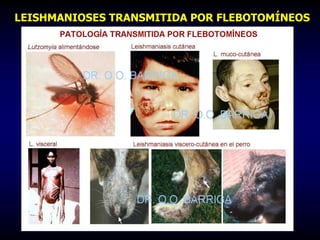 LEISHMANIOSES TRANSMITIDA POR FLEBOTOMÍNEOS
 