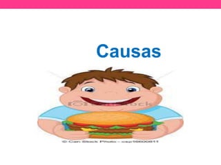 Causas
 