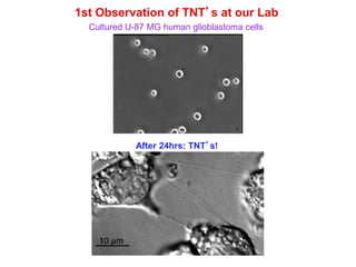 1st Observation of TNT’s at our Lab
Cultured U-87 MG human glioblastoma cells
After 24hrs: TNT’s!
 
