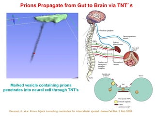 Prions Propagate from Gut to Brain via TNT’s
Marked vesicle containing prions
penetrates into neural cell through TNT’s
Gousset, K. et al. Prions hijack tunnelling nanotubes for intercellular spread. Nature Cell Biol. 8 Feb 2009
 