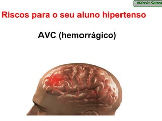 Márcio Souza


Riscos para o seu aluno hipertenso

        AVC (hemorrágico)
 