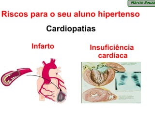 Márcio Souza


Riscos para o seu aluno hipertenso
           Cardiopatias

       Infarto       Insuficiência
                       cardíaca
 