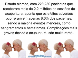 Estudo alemão, com 229.230 pacientes que
receberam mais de 2,2 milhões de sessões de
acupuntura, aponta que os efeitos adversos
ocorreram em apenas 8,6% dos pacientes,
sendo a maioria eventos menores, como
sangramentos e hematomas. Complicações mais
graves devido à acupuntura, são muito raras.
 